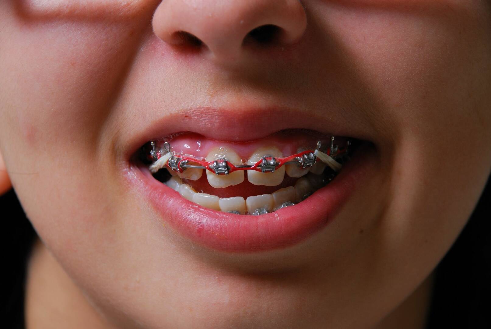 Papandreas Orthodontics